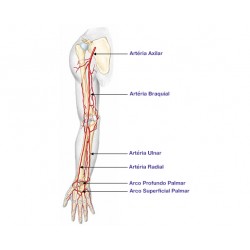 Pressão Arterial Invasiva (PAI)