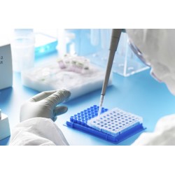 Diagnóstico por Elisa e Imunofluorescência  TRAMMIT MEDICAL