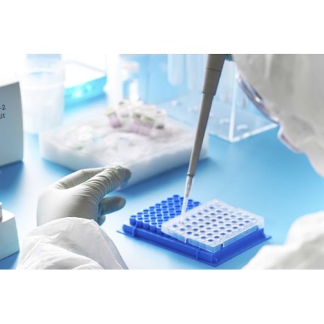 Diagnóstico por Elisa e Imunofluorescência  TRAMMIT MEDICAL