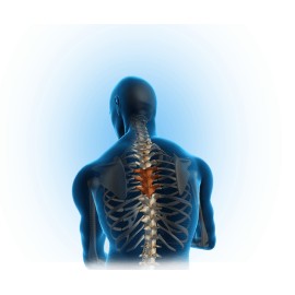 Cimento cirúrgico VERT-MAXX