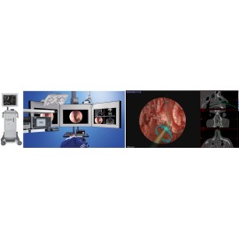 Equipamentos para Otorrinolaringologia